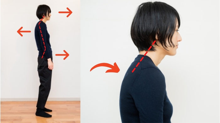 現代人に多く見られる猫背&ストレートネック