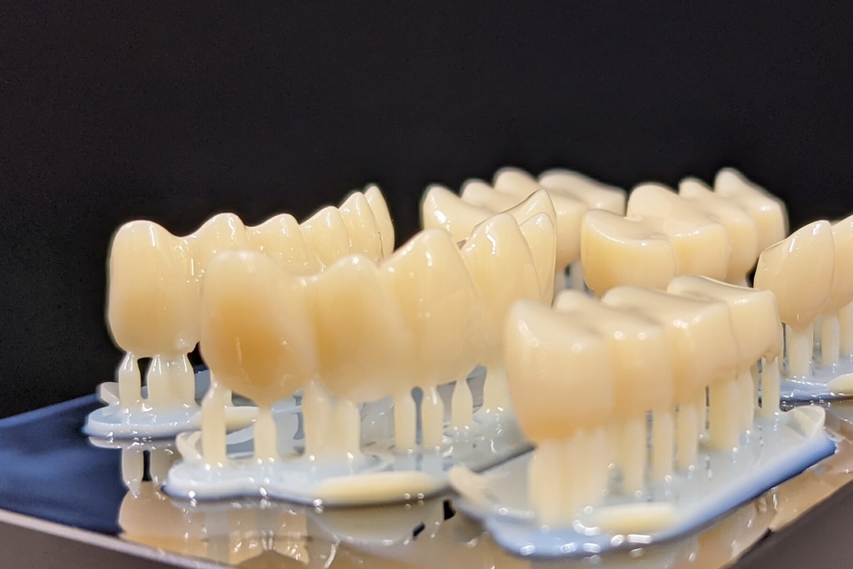 保管データを元に3Dプリンターで作った歯