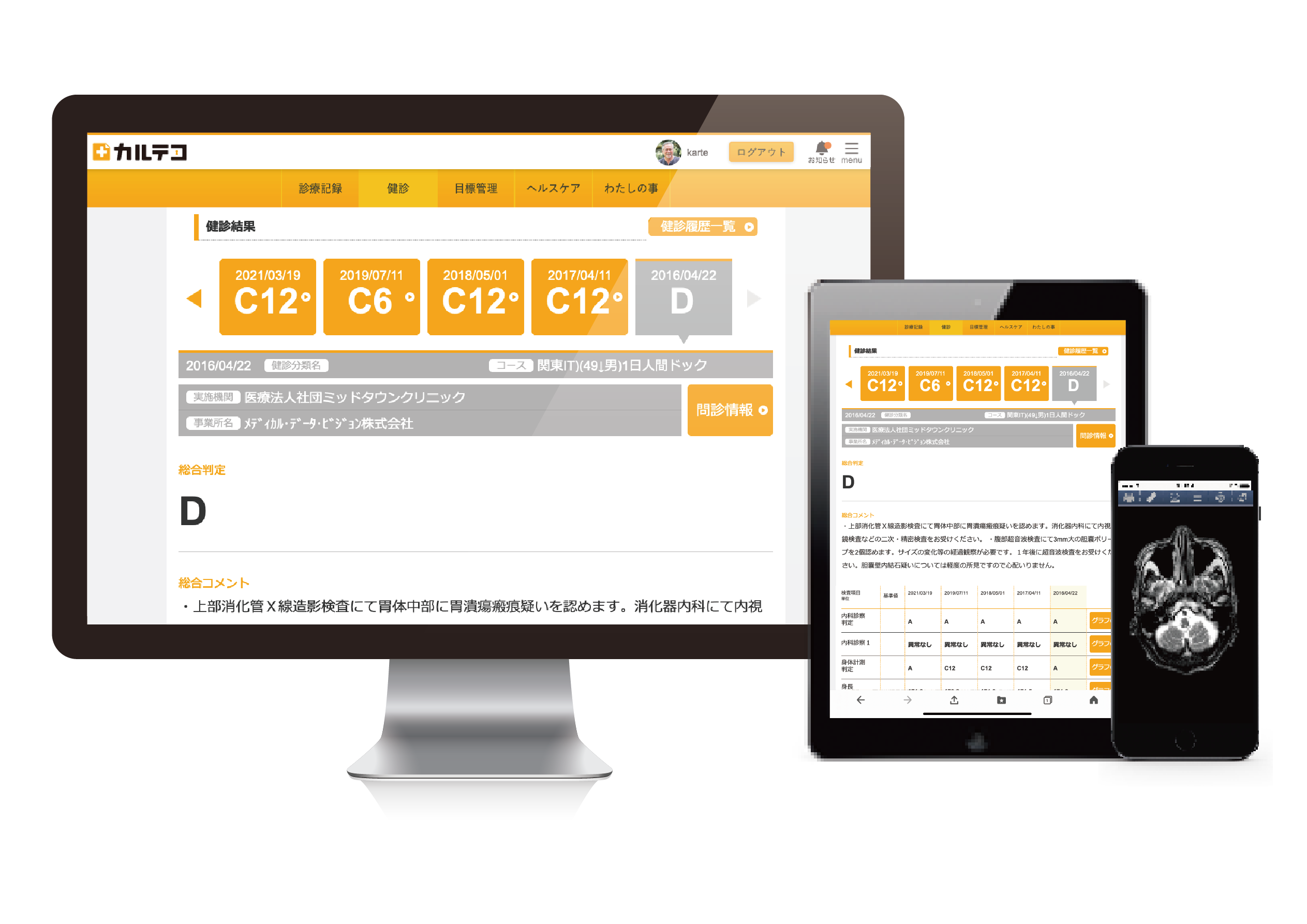 健診版PHRサービス「カルテコ」、リリース　検査結果の経年比較容易に、施設内オペレーション効率化