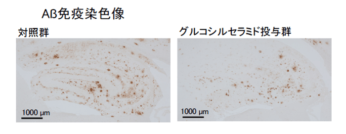<アミロイドβペプチド斑の減少>※グルコシルセラミド投与群では、発症原因の一つとされるアミロイドβペプチドが減少していることが確認された