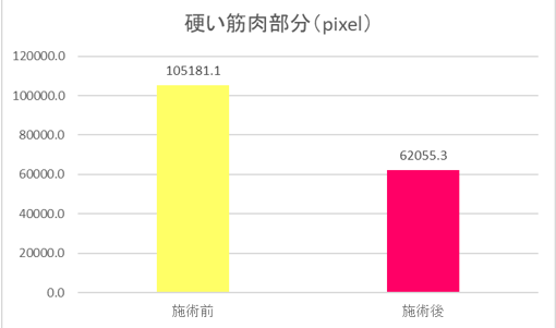 医師監修の臨床試験でも効果が実証されました