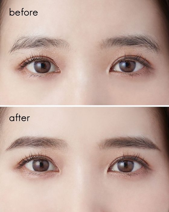 眉カットビフォーアフター