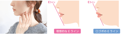 理想的なEライン
