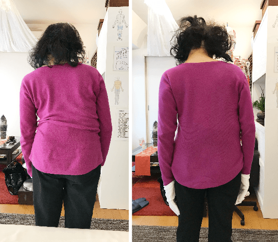 左から施術前と施術後腰に痛みを抱えていた