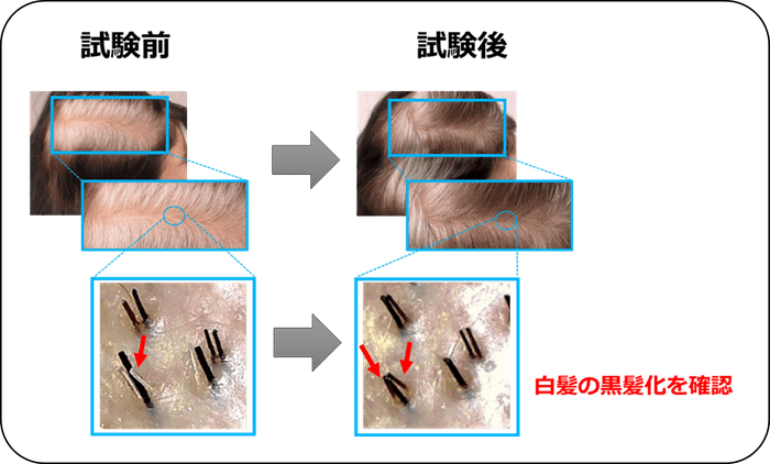 図3:明確な白髪の改善を複数確認