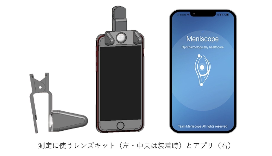商品画像(レンズキットとアプリ)