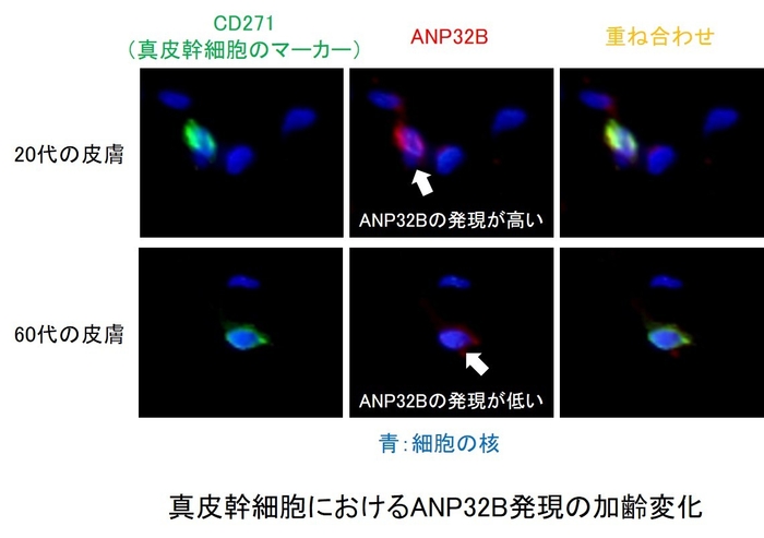 ANP32B発現の加齢変化