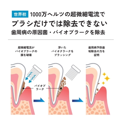歯周病の原因菌・バイオプラークを除去