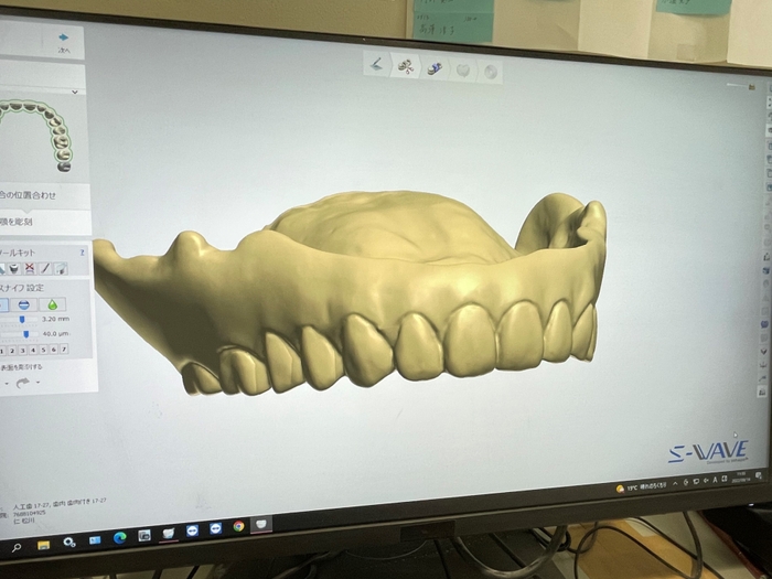 手順4. データが3Dに変換され保管