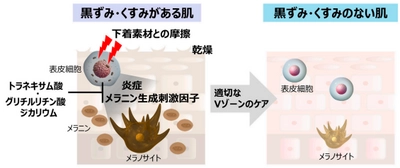 Vゾーンの脱毛後、黒ずみ・くすみが起こる原因を解析