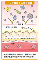 バリア機能が正常の場合