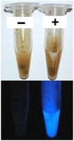 ルミノール反応による便潜血の検出法を確立　法医学で血痕検出に用いられる試薬の応用