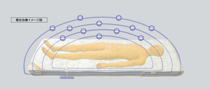 電位治療のイメージ