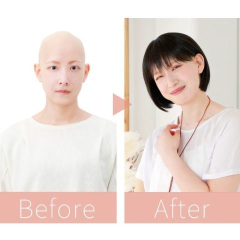 【フィット】 Before After