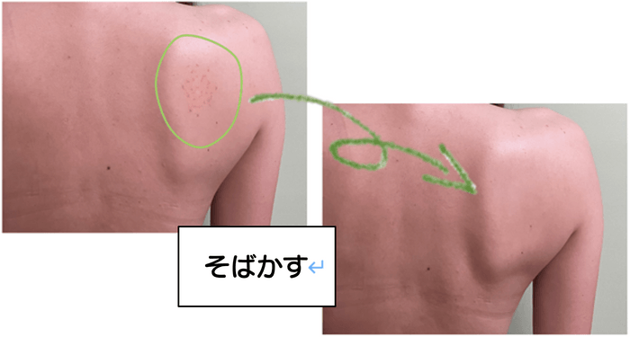 そばかす隠し