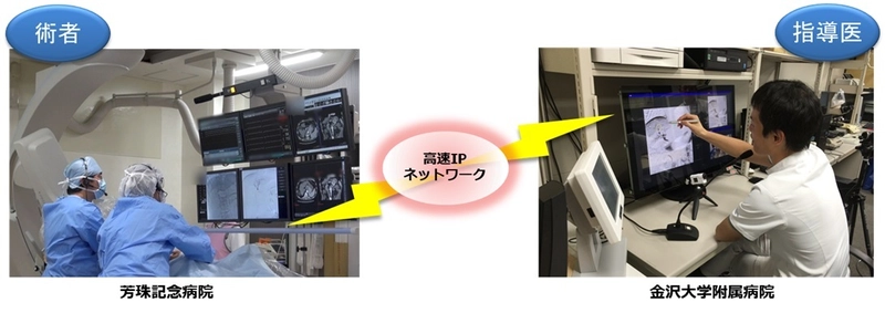 国内初、金沢大学附属病院と芳珠記念病院間で 4K映像伝送による血管内治療・遠隔医療指導の 実証実験を実施