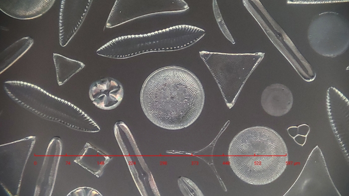 撮影例(プランクトン・珪藻)