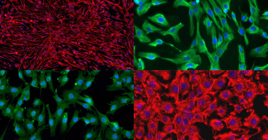 クラウドクローン社の初代細胞