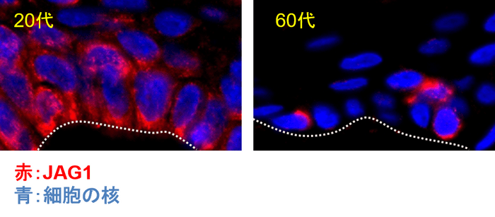 図4　ヒト表皮におけるJAG1発現の加齢変化