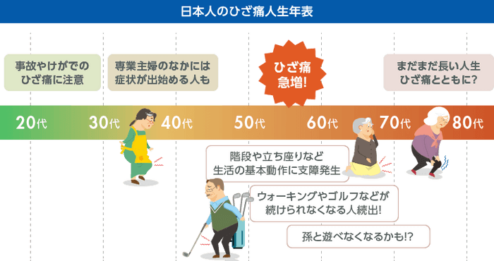 日本人の「ひざ痛人生年表」