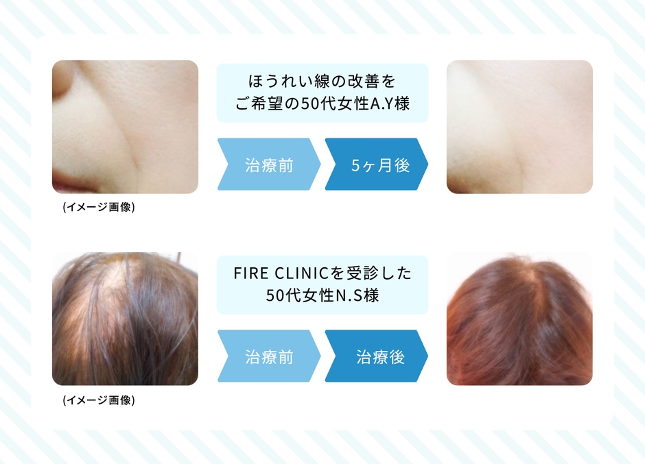 症例写真 イメージ画像