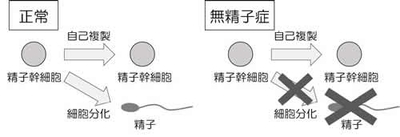 図1．精子ができる仕組み。正常な精巣では、精子幹細胞は自己複製しつつ、細胞分化によって精子を形成します（左）。しかし、精子幹細胞に細胞分化異常が生じると、精子が作られずに無精子症となります（右）。