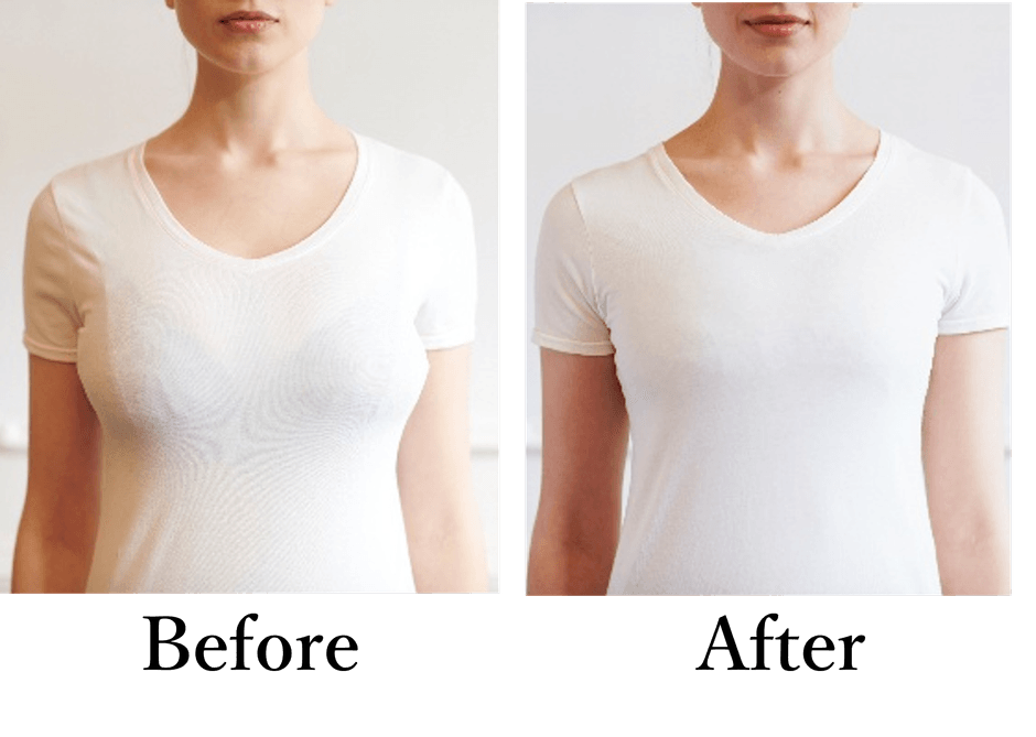 横に広がった胸もスッキリ抑えます