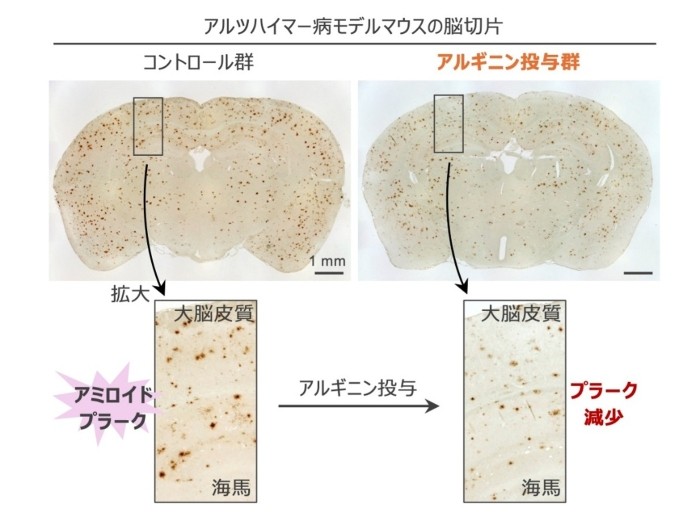 図2 アルツハイマー病モデルマウスの脳切片画像、茶色の斑点がアミロイドβの蓄積を表す。 (左)コントロール群、(右)アルギニン投与群