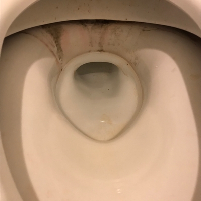 トイレの黒ずみ