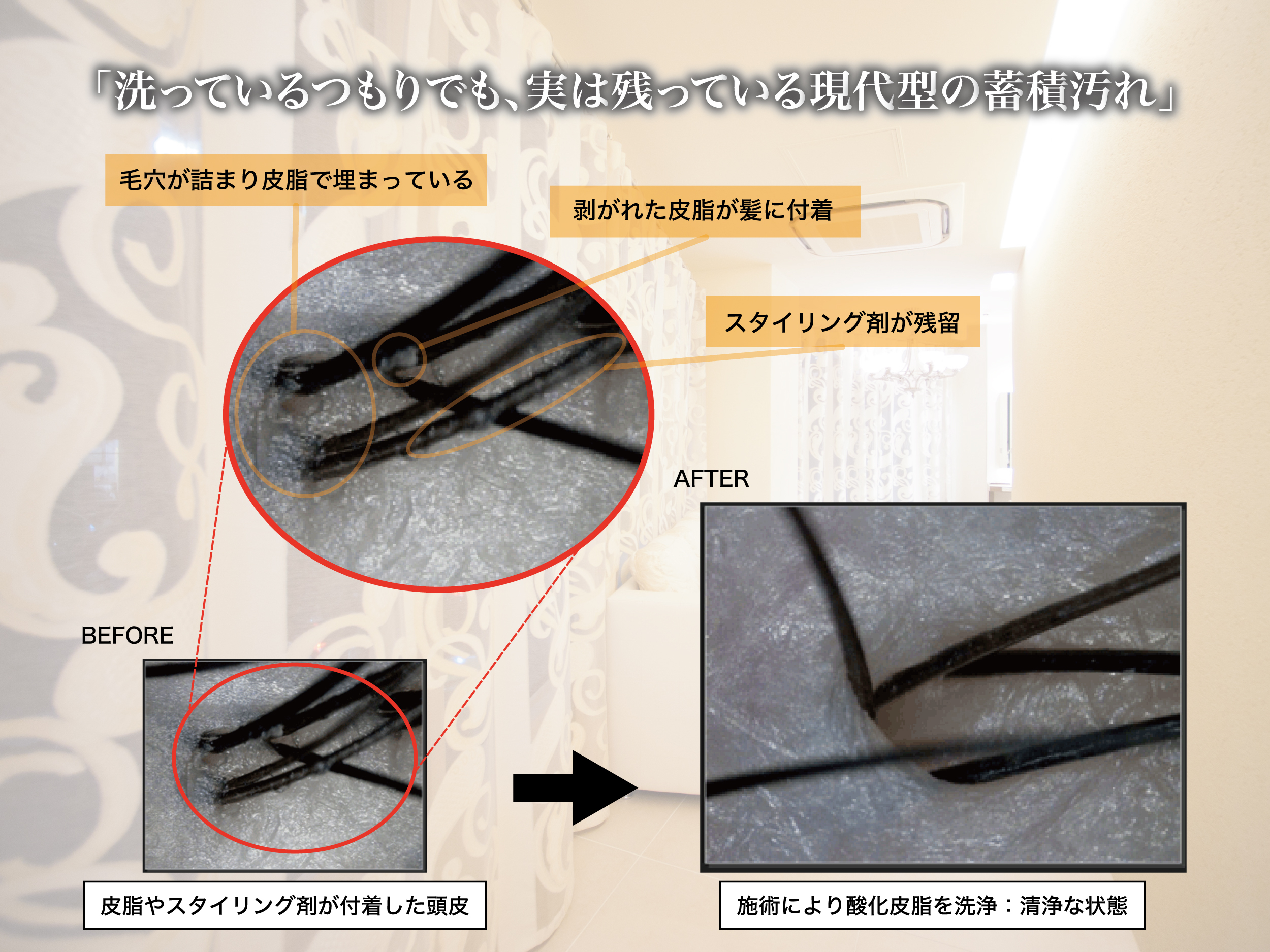 マイクロスコープ