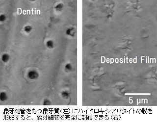 象牙細管をもつ象牙質（左）にハイドロキシアパタイトの膜を形成すると、象牙細管を完全に封鎖できる（右）