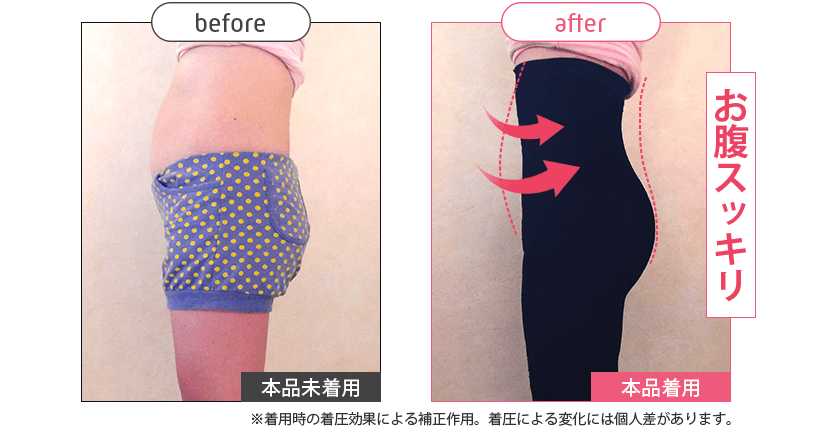 ストレグ横腹Before／After