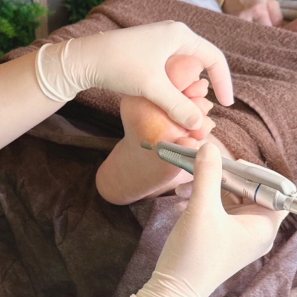 専用マシンで角質や魚の目をケアする施術風景」