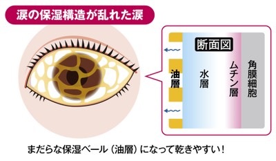図8) 涙の保湿構造が乱れた涙