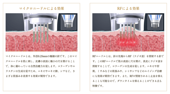 ポテンツァの特徴