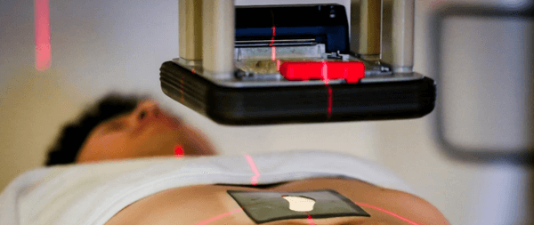 放射線遮蔽材「シーラーSTR」の使用イメージ