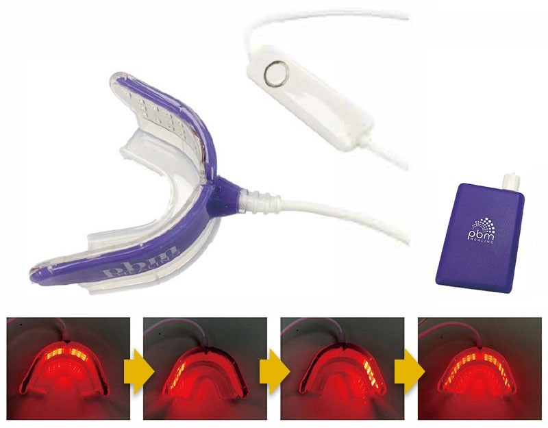 インプラントの定着スピードを劇的に向上