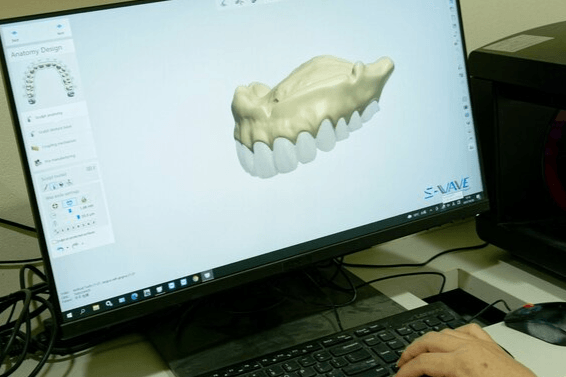 スキャンした入れ歯データを保管中