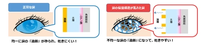 ドライアイ(目の乾き)の要因として、涙の蒸発に着目　 蒸発を防ぐベールとしてはたらく涙の「油層」を、 安定化させる成分を発見！