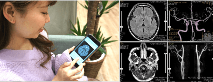 「スマート脳ドック」の特徴