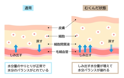 むくみの原因