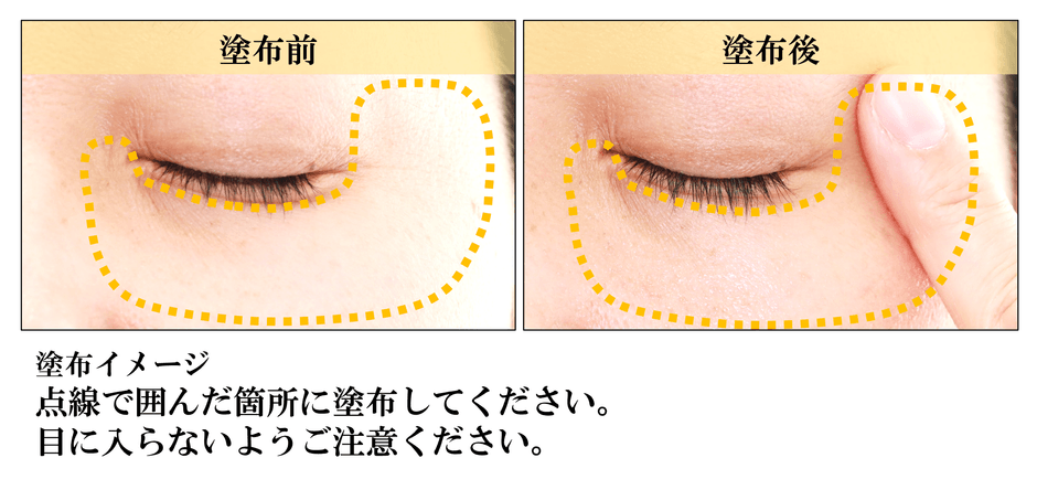 メトラッセ プランプセラム_塗布イメージ_1