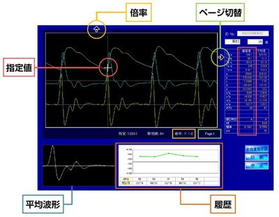 測定結果画面