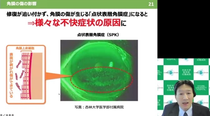 デジタル社会の進展で増大する角膜の傷リスク~目の酷使による角膜の傷への影響とその対処法~(山田先生)