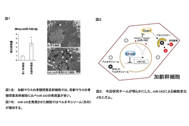 再生医療に使われる骨髄間葉系幹細胞の新しい老化メカニズムを発見　細胞老化を抑制するなど、再生医療技術の発展の可能性