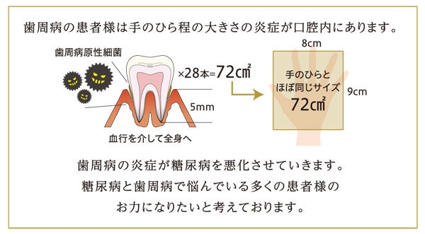 歯周病の炎症