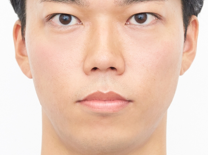 C:唇が荒れていない男性