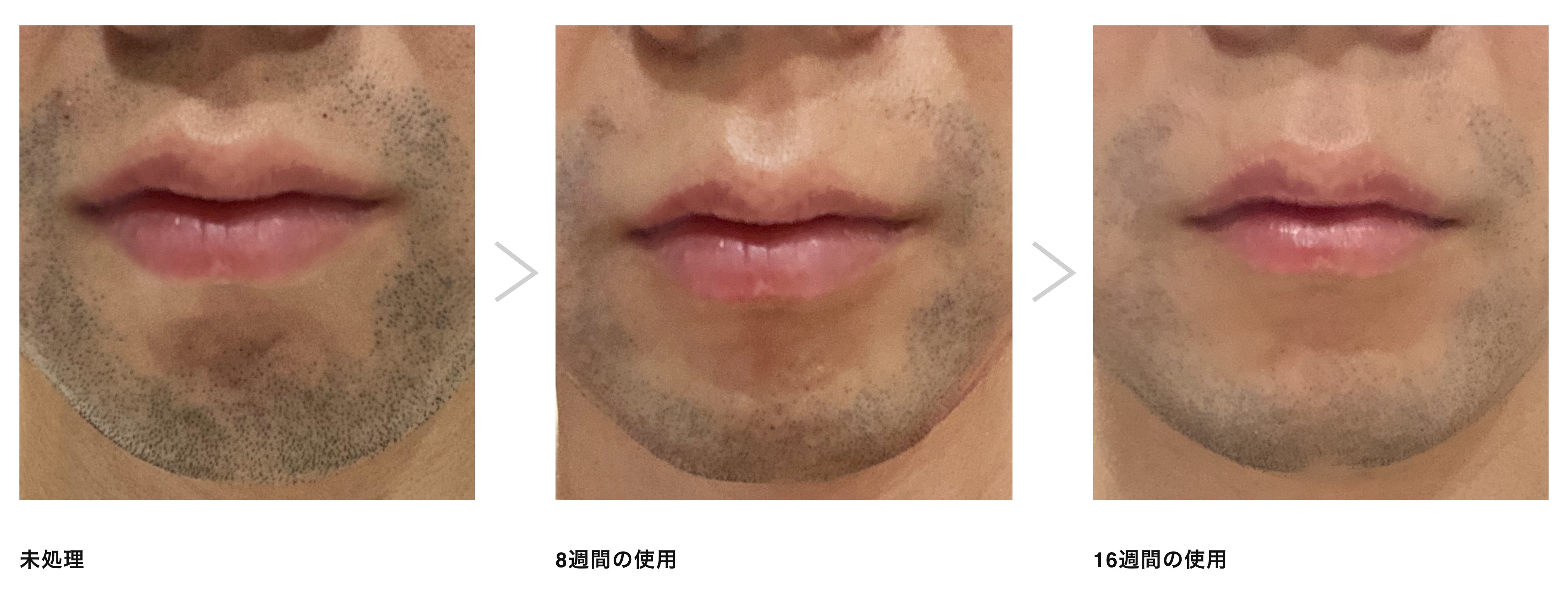 定期的なフェイスケア