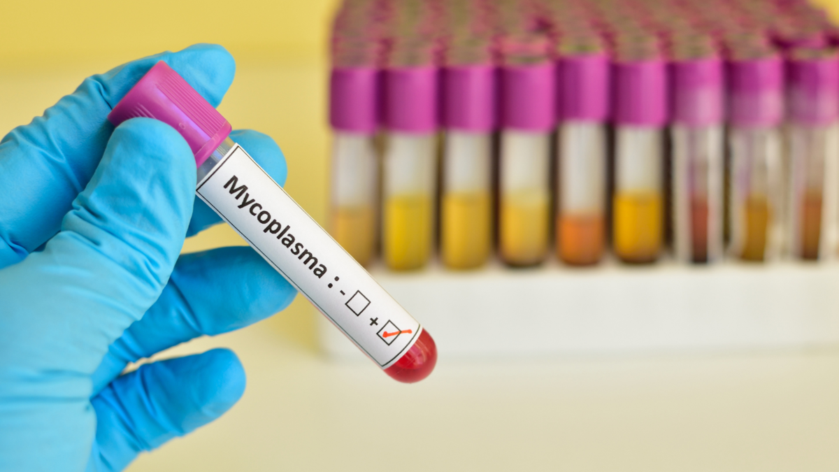 世界のマイコプラズマ検査市場の期待は、需要の増加とトレンドの変化により急増 2027年までの業界分析による