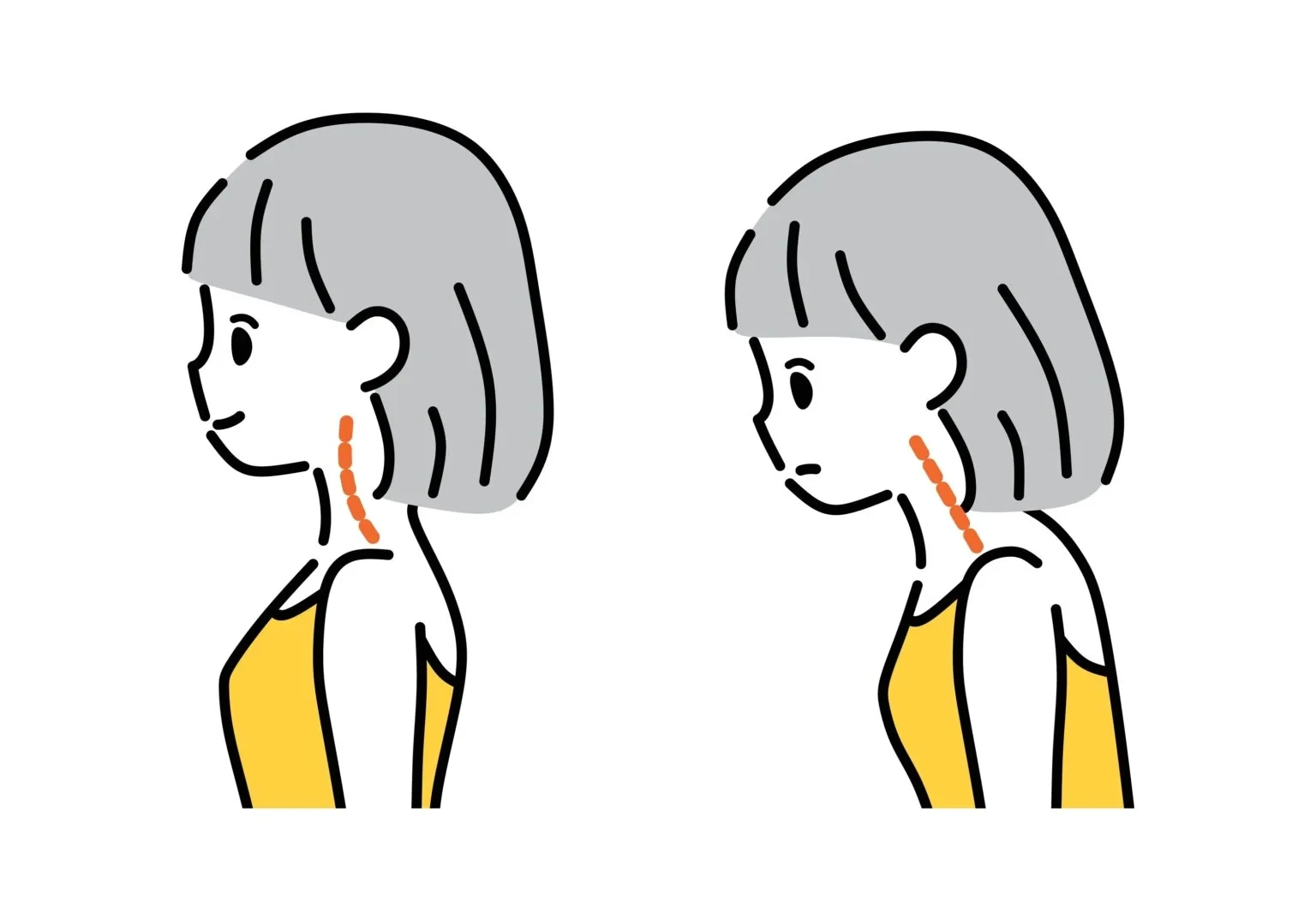 ストレートネックに悩む人の枕選びのポイント丨首枕やタオル枕の注意点も解説